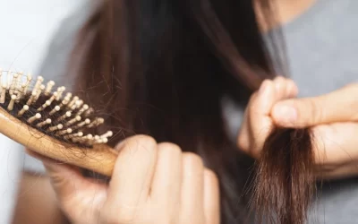 La Fibrosis Quística puede causar la caída del cabello